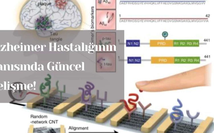  Alzheimer Hastalığının Tanısında Güncel Gelişme!